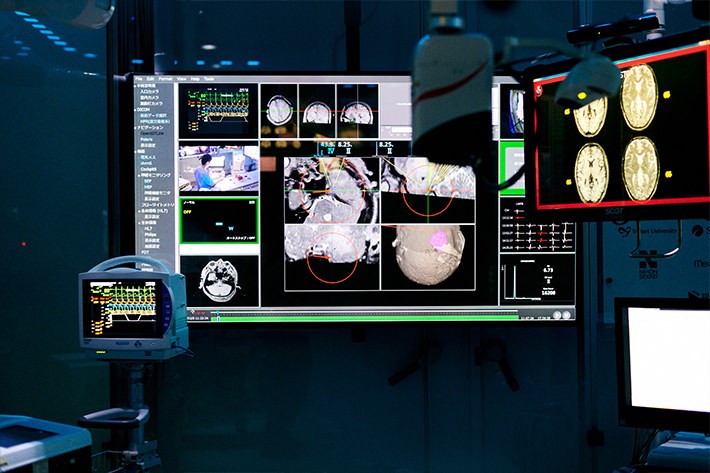 スマート治療室「SCOT」とは「車」みたいなもの?
